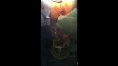 Stretchy Vagina Gives Birth Screams When It Is All Over Best Gore young woman scream give birth(1) mp4